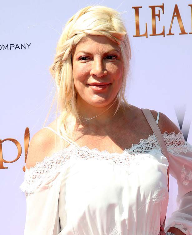 Tori Spelling über ihren Fauxpas im Gesicht