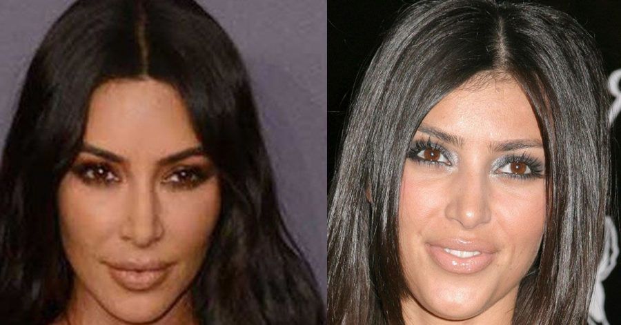 Kim Kardashian hatte nie eine Nasen-Op – sagt sie