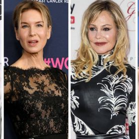 Promis, die sich mit Beauty-OPs die Karriere versauten (Teil 2)