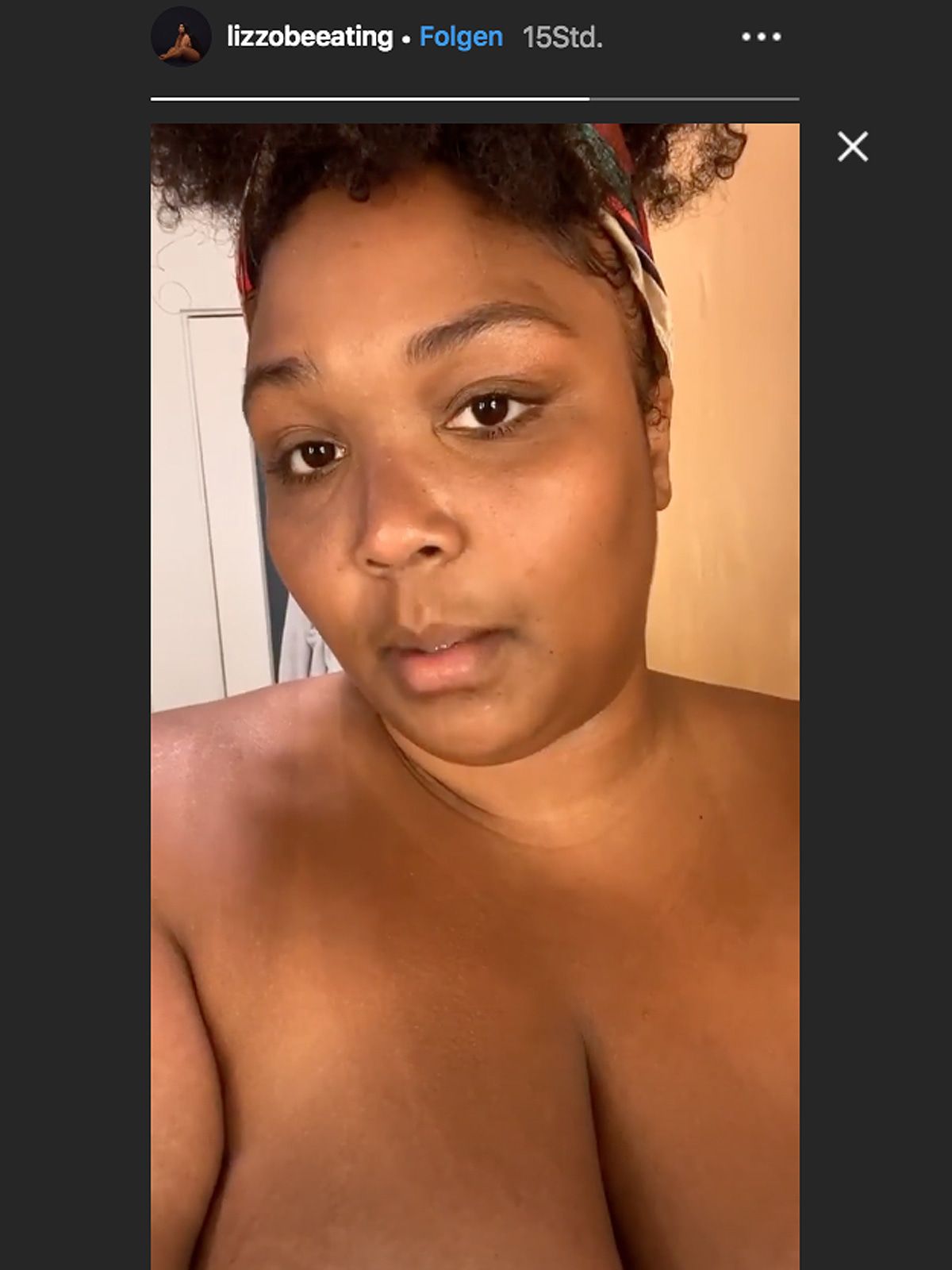 Lizzo feiert sich für ihre Bräunungsergebnisse