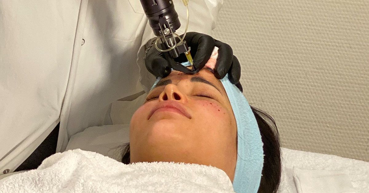 Micaela Schäfer lässt sich zur Verjüngung Eigenblutplasma spritzen