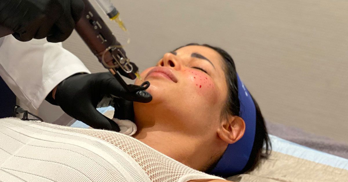 Micaela Schäfer bekommt einfach nicht genug von Beauty-Eingriffen