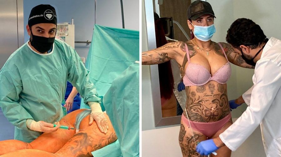 Kate Merlan: Brazilian Butt Lift & Fettabsaugung wegen Liebeskummer
