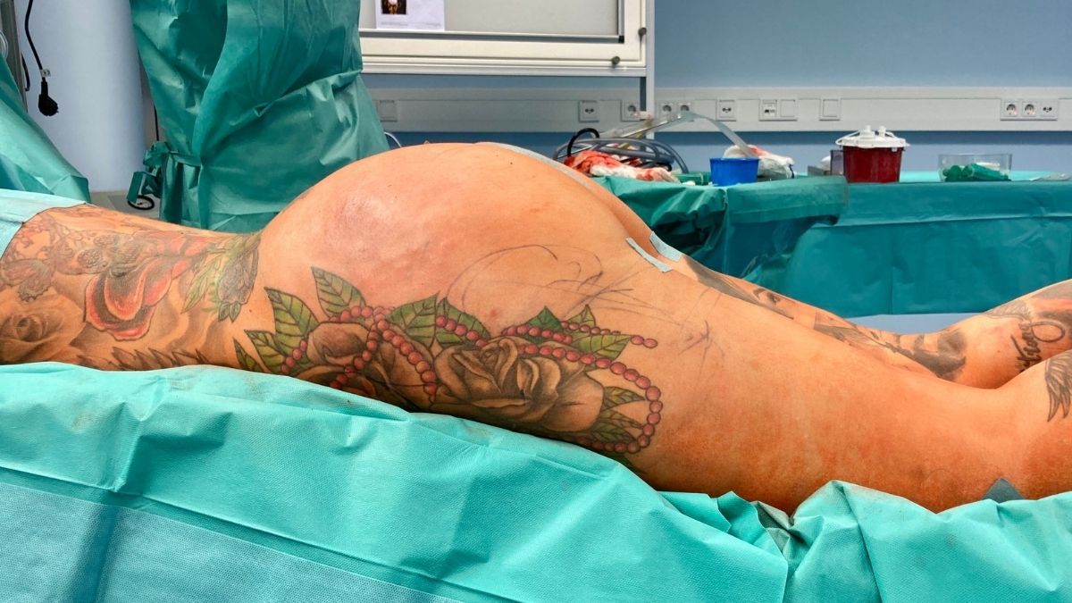 Kate Merlan: Brazilian Butt Lift & Fettabsaugung wegen Liebeskummer