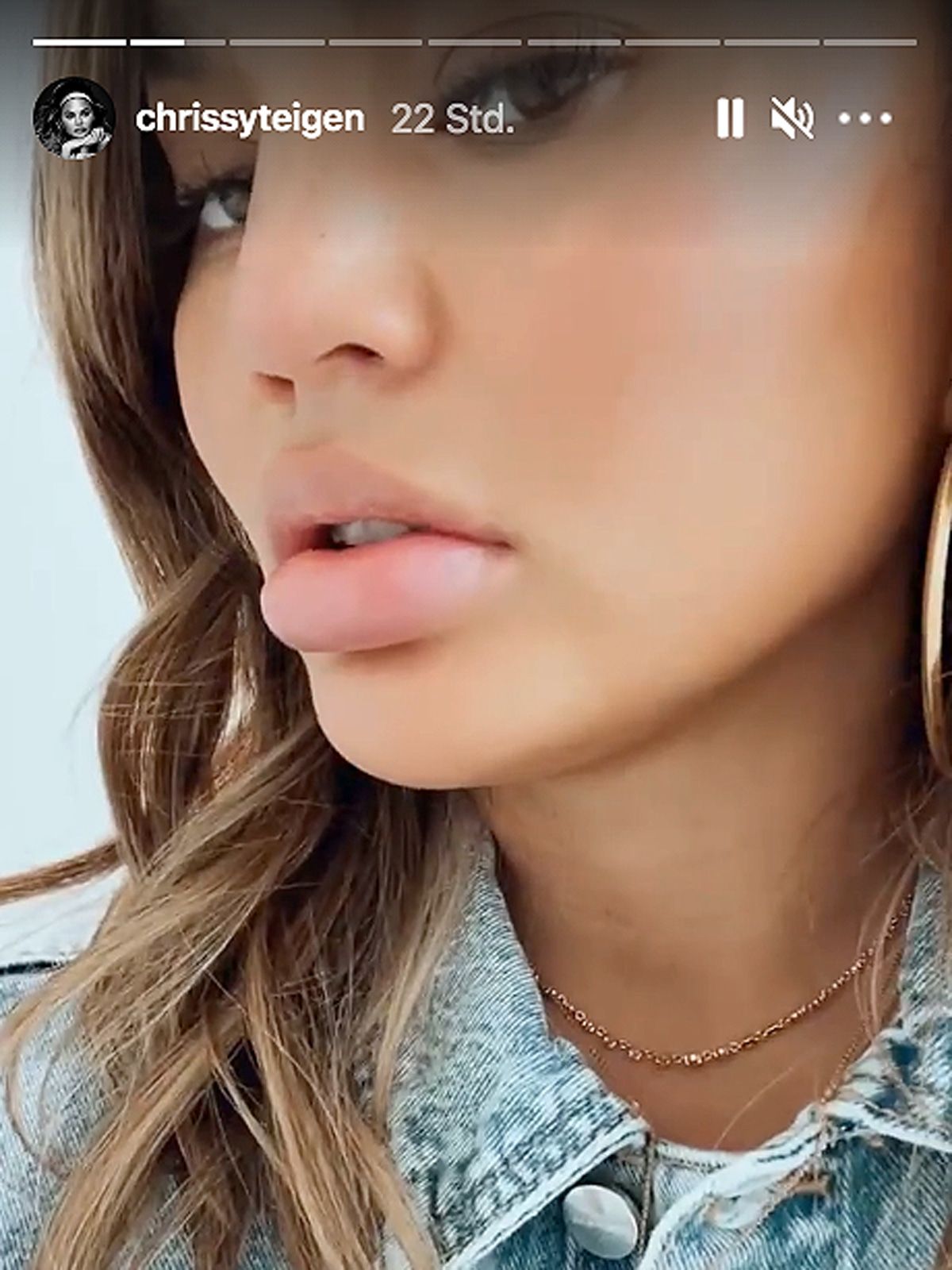 Chrissy Teigen riskiert hier ne' dicke Lippe