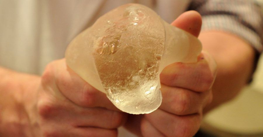 Ein defektes Silikonkissen der französische Billig-Brustimplantate-Firma Poly Implant Prothese (PIP).