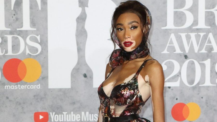 Liebt Blumen nicht nur auf dem roten Teppich: Winnie Harlow (kms/spot)