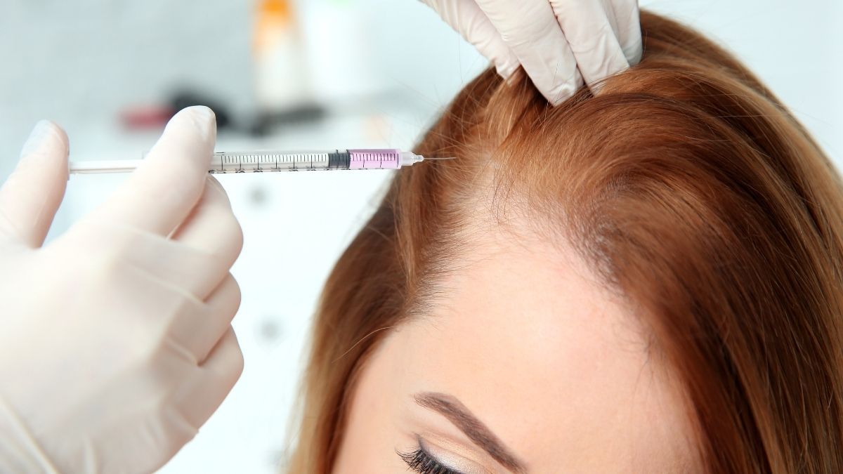 Geheimratsecken bei Frauen: Effektiv behandeln mit Haarlinienkorrektur
