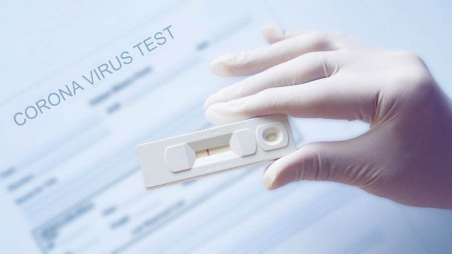 Corona-Tests werden für den Grenzübertritt aus Frankreich essenziell. (mia/spot)