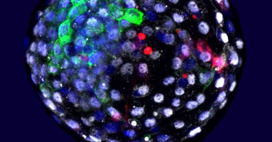 Das Bild zeigt eine Chimäre Mensch-Affe-Blastozyste. Wissenschaftler haben Embryonen aus Zellen von Mensch und Affe erzeugt.