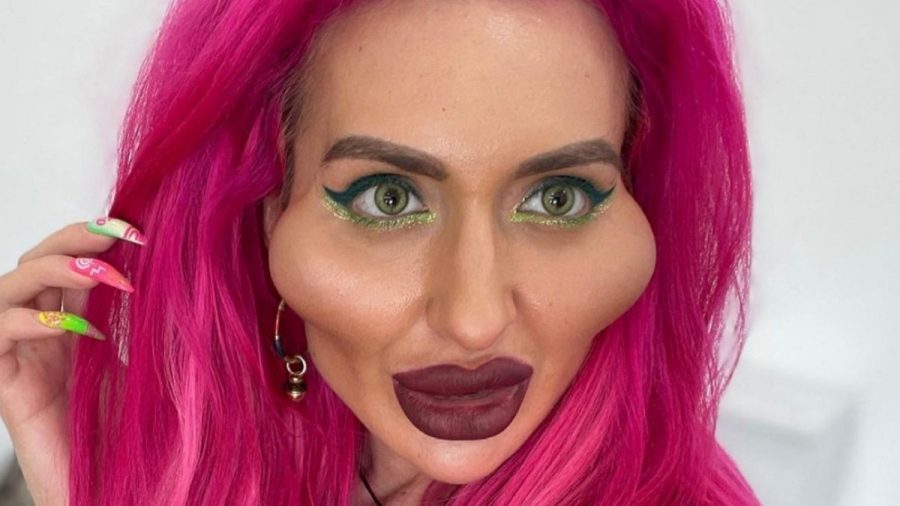 Influencerin mit XXL-Wangen: So schön und natürlich war sie früher!