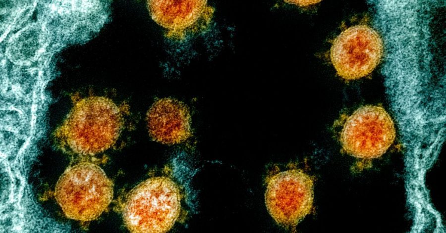 Diese elektronenmikroskopische Aufnahme aus dem Jahr 2020 wurde farblich bearbeitet und zeigt Partikel des Coronavirus SARS-CoV-2.