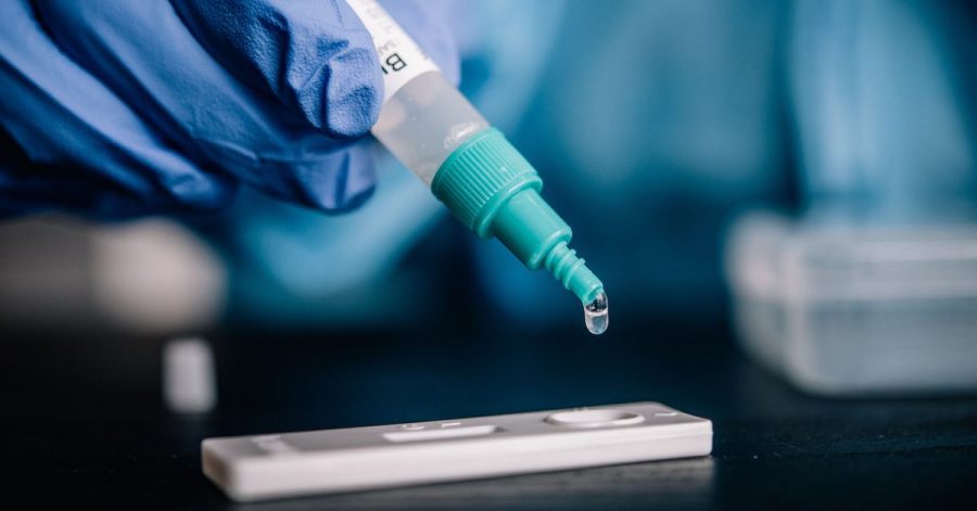 Für einen Schnelltest braucht es Biomasse aus der Nase oder dem Rachen - aber keine Personalausweisnummer.