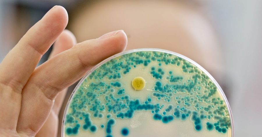 Eine Labormitarbeiterin hält eine Schale zum Nachweis von Antibiotika-resistenten Bakterien in der Hand.