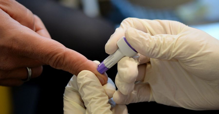 Die Corona-Pandemie hat möglicherweise dazu geführt, dass weniger Menschen auf HIV getestet wurden.
