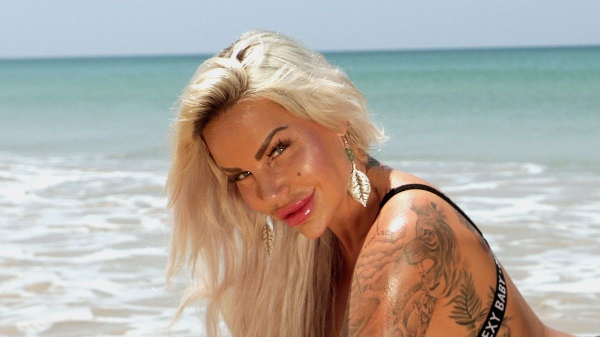 Gina-Lisa Lohfink: Was ist mit ihrem Gesicht passiert? Ein Facharzt klärt auf!