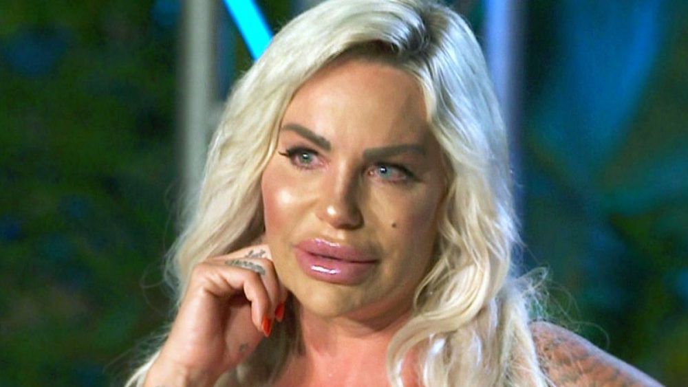 GinaLisa Lohfinks Gesicht! Arzt warnt GinaLisa Lohfinks Gesicht! Arzt warnt