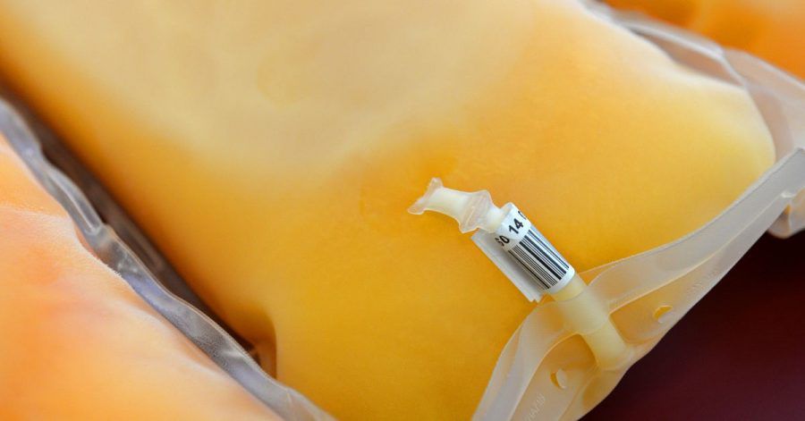 Blutplasma sieht gelblich aus. Mehr als die Hälfte unseres Blutes besteht daraus.