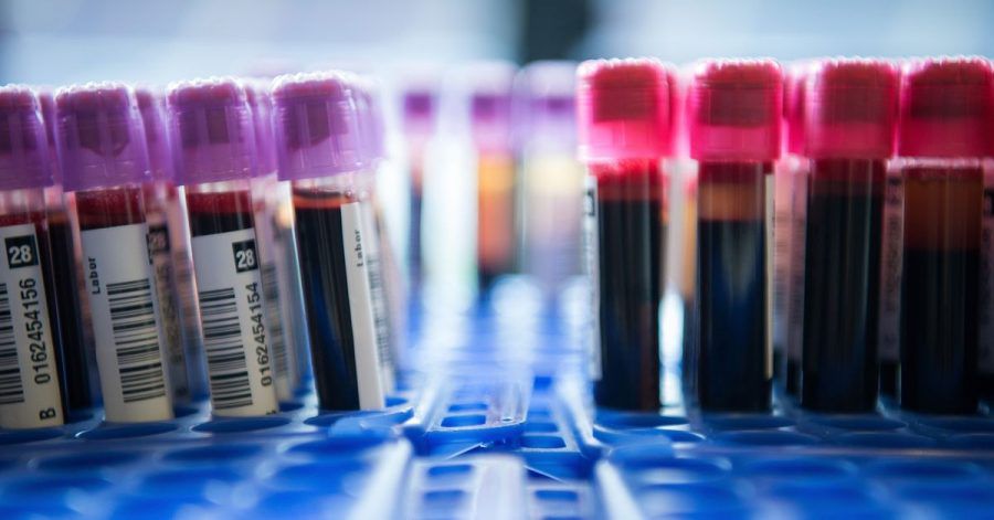 Spezielle Tests können Erbgut von Krebszellen im Blut nachweisen.