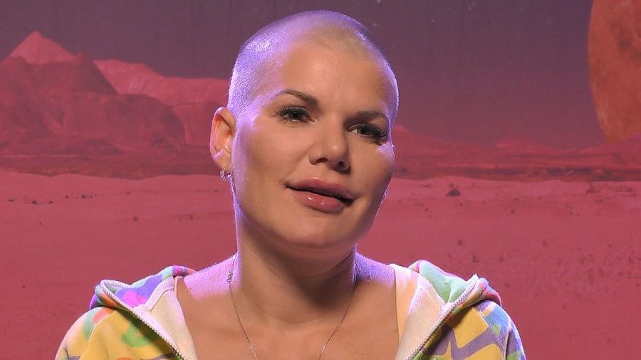 Sylvie Meis will mit Botox in Würde altern