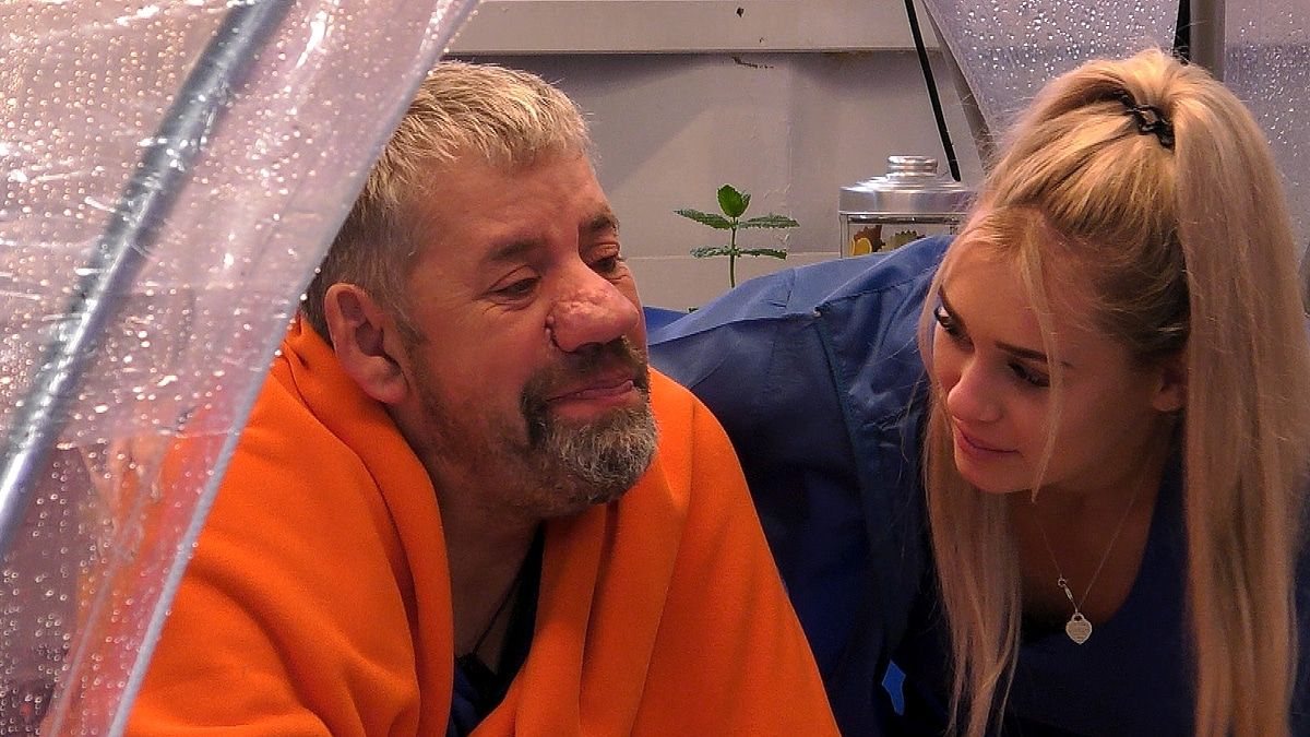Uwe Abel: Kann die große Nase operiert werden? Das sagt ein Facharzt!