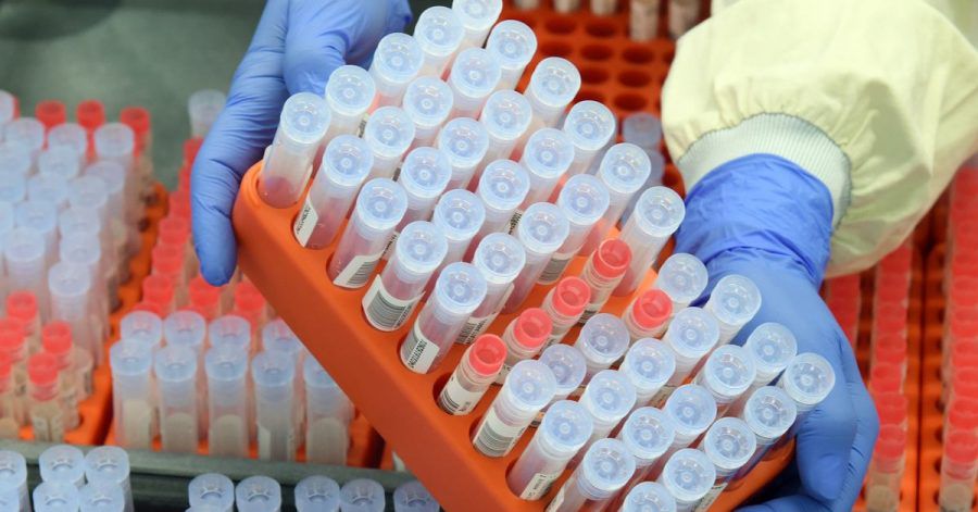 Die Leiterin der PCR-Abteilung entnimmt SARS-CoV-2-Proben aus dem Archiv für Kontrollmessungen. (Archivbild)