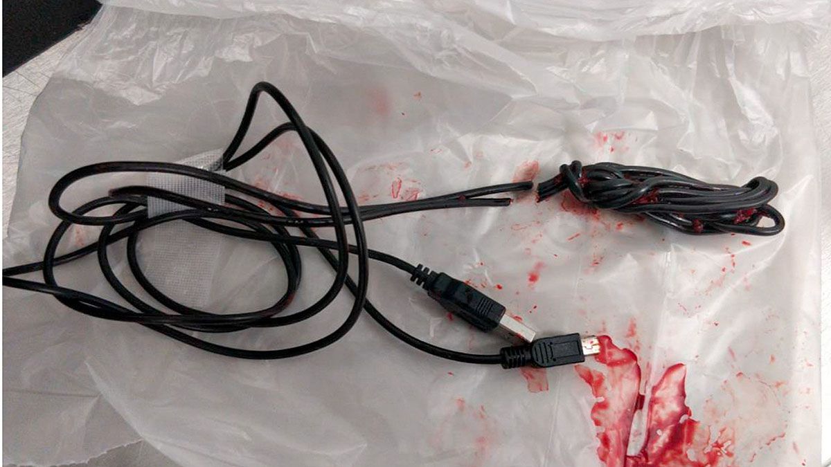 USB-Kabel im Penis: Wer macht denn sowas?