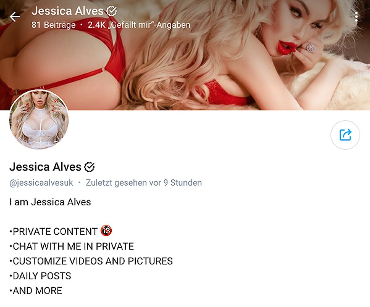 Transgender Jessica Alves will sich komplett nackig machen
