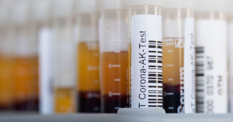 November 2021: Für einen Antikörpertest wird Blut abgenommen und analysiert.