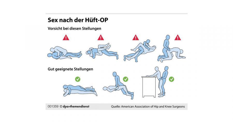 Auf manche Sexpositionen verzichtet man nach einer Hüft-OP lieber erstmal - es gibt ja zum Glück ausreichend unbedenkliche Alternativen.