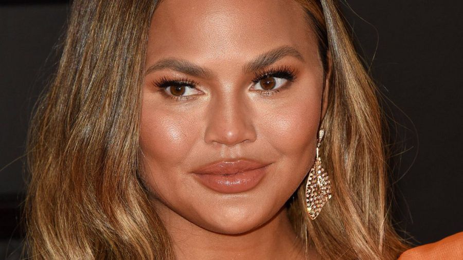 Chrissy Teigen erklärt ihre Augenbrauen-Transplantation