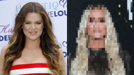 Fans erkennen Khloe Kardashian nicht wieder: Was ist mit ihrem Gesicht passiert?