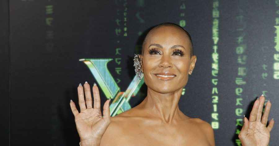 Die US-Schauspielerin Jada Pinkett Smith leidet unter Haarausfall.