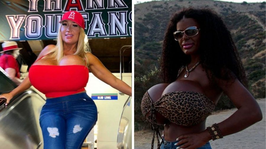 Allegra Cole, Martina Big & Co.: Sind diese XXXL-Brüste lebensgefährlich?