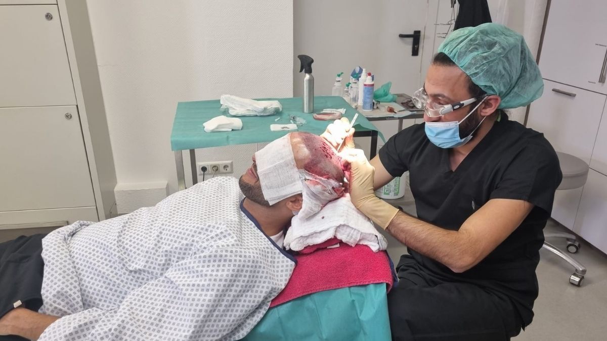 Domenico de Cicco schwört dem Toupet ab: Er macht Haartransplantation