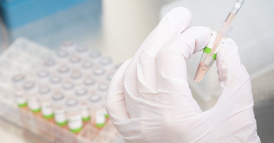 PCR-Tests im Labor.