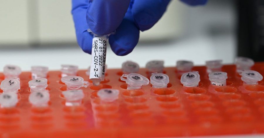 Die Mitarbeiterin eins PCR-Labors in Stuttgard bereitet Tests vor.