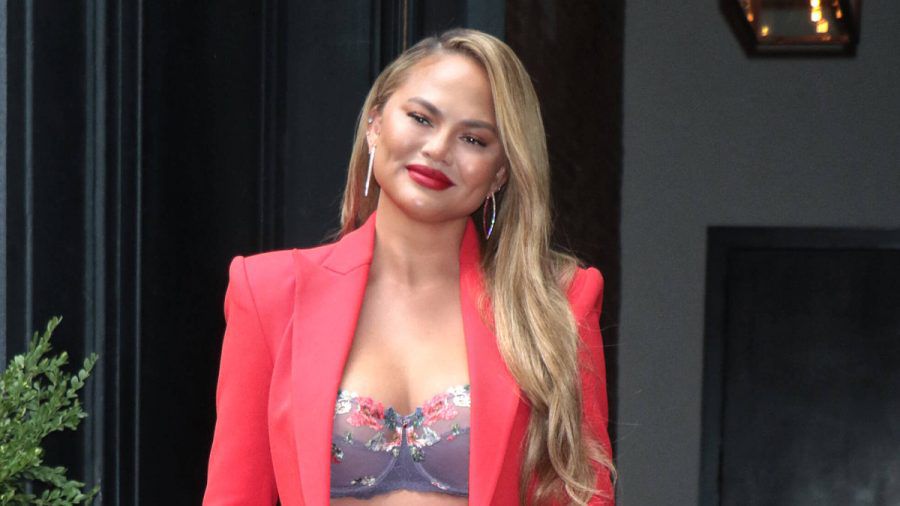 Chrissy Teigen schwer genervt von ihrer Akne