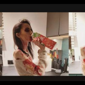 Ist das Kunst oder krank? Mager-Model Wilkomira