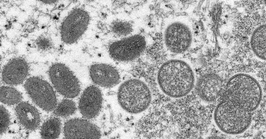 Diese elektronenmikroskopische Aufnahme zeigt reife, ovale Affenpockenviren (l) und kugelförmige unreife Virionen (r), die aus einer menschlichen Hautprobe stammt.