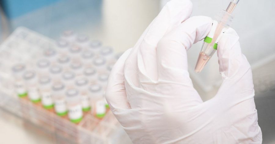 Eine biologisch-technische Assistentin bereitet im Niedersächsischen Landesgesundheitsamt PCR-Tests für die Analyse vor.