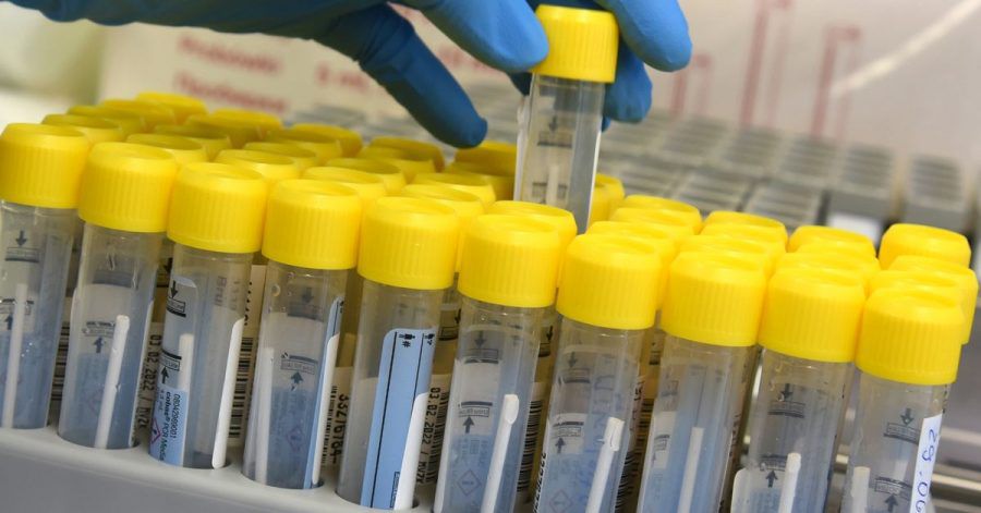 Im PCR-Labor bereitet eine medizinisch technische Laborassistentin die Bearbeitung von PCR-Tests vor.