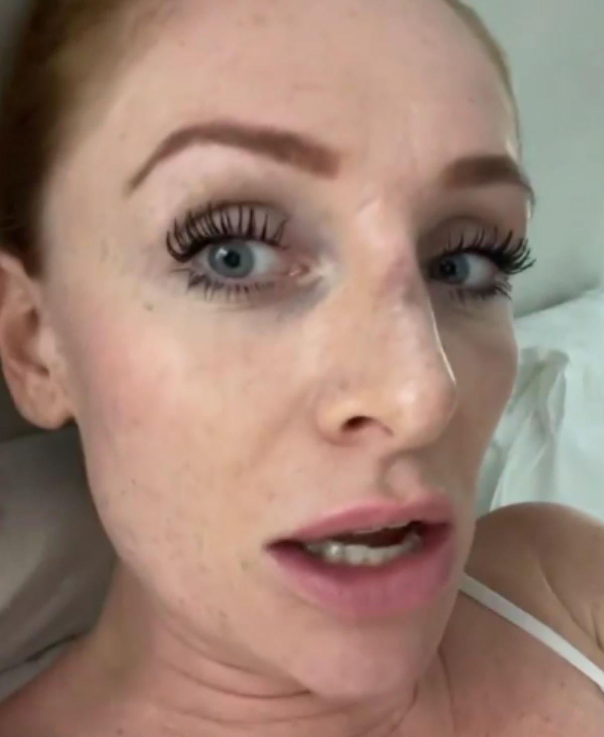 Georgina Fleur zeigt ihre Nase nach dem Eingriff