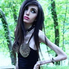 Eugenia Cooney ist magersüchtig - und trotzdem eine Internetberühmtheit