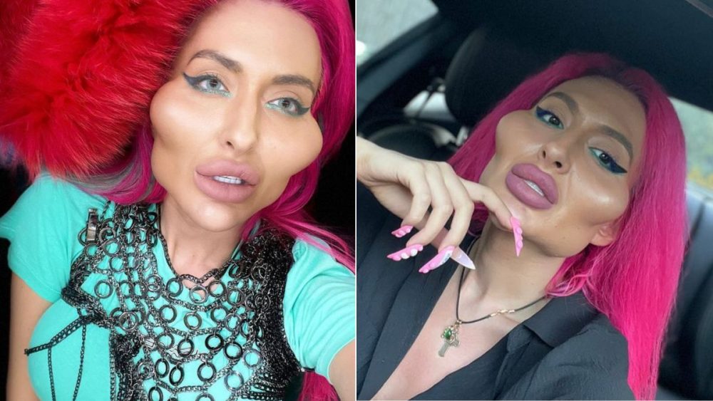 Riesige Brüste hat Model und Influencerin Allegra Cole schon! Jetzt