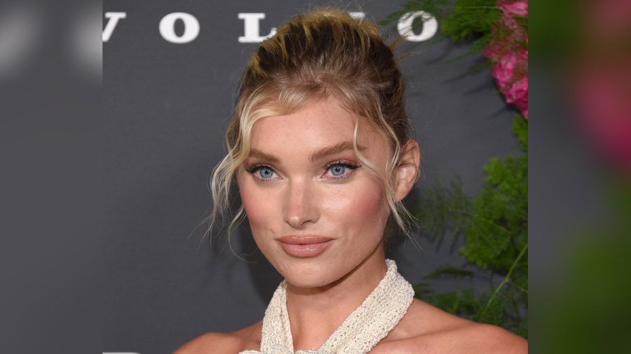 Scandi Hairline: Das schwedische Model Elsa Hosk gilt als Vorbild für den TikTok-Beautytrend. (the/spot)