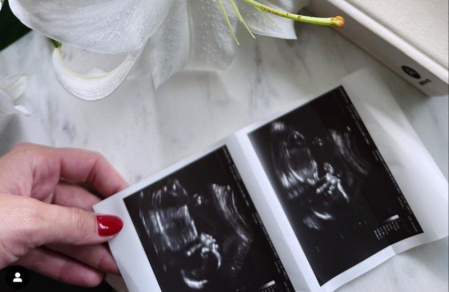 Josh Duhamel and Audra Mari ultrasound pregnancy announcement - ONE USE Instagram - September 2023 BangShowbiz