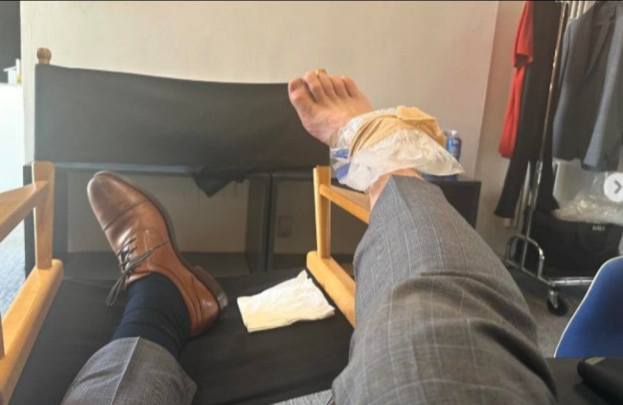 Chris Pratt injured foot April 2024 Instagram ONE USE BangShowbiz