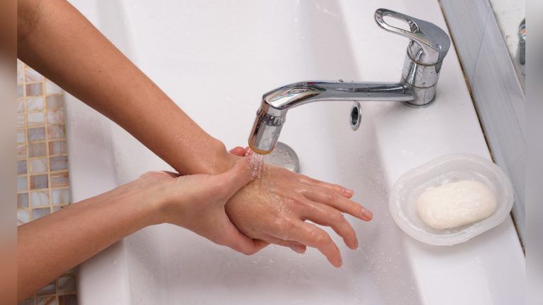 Was Hilft Bei Verbrennungen Am Finger www.klatsch-tratsch.de