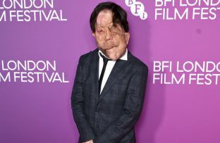Adam Pearson - October 2026 - Getty Images - BFI London Film Festival BangShowbiz
